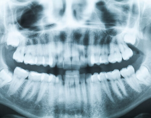 Photo of Digital X-Ray